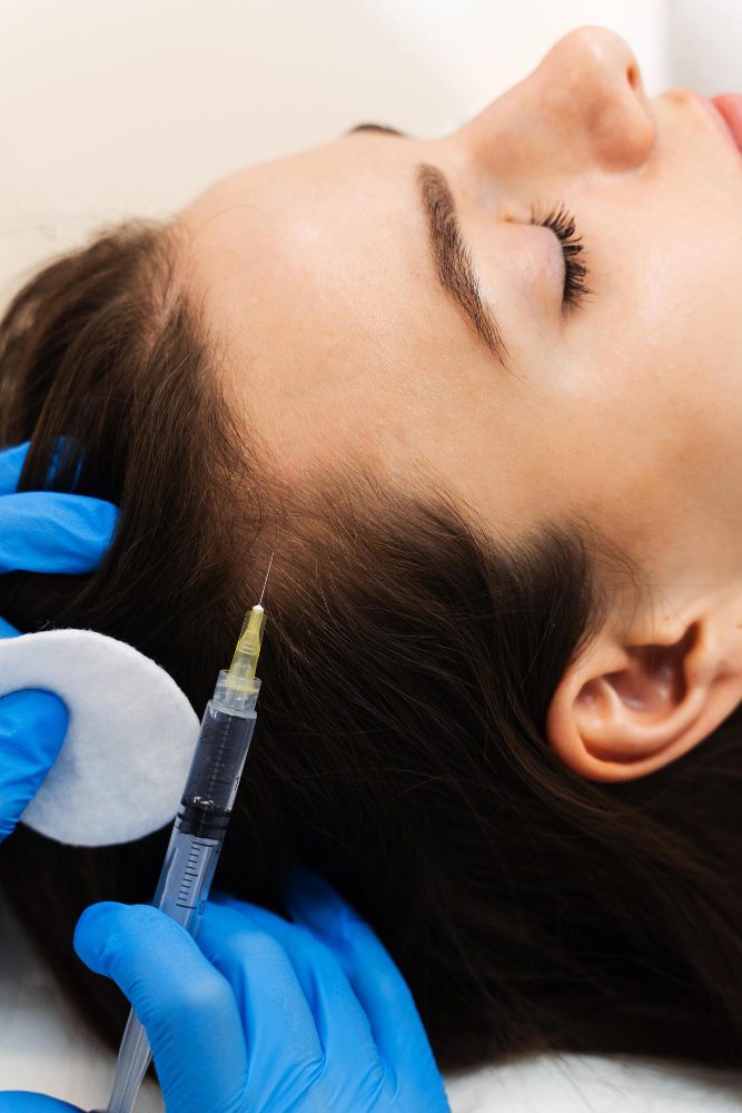 Mesotherapy for Hair in Dehradun at SKIHT clinic