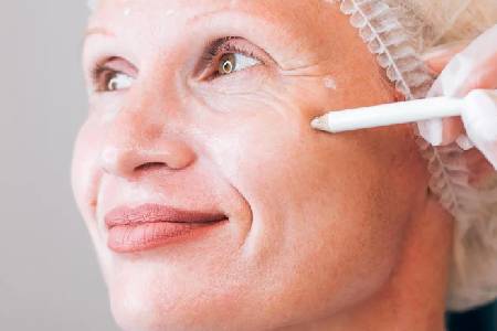 Anti Wrinkles Treatment