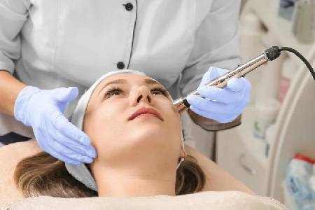 Acne Laser Treatment